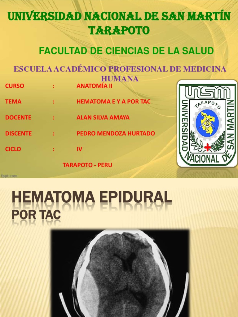Hematoma Epidural y Subdural | Descargar gratis PDF | Lesión | Sistema ...