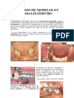 Paralelómetro Componentes y Funciones