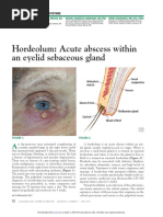 Stye | PDF | Ophthalmology | Rtt