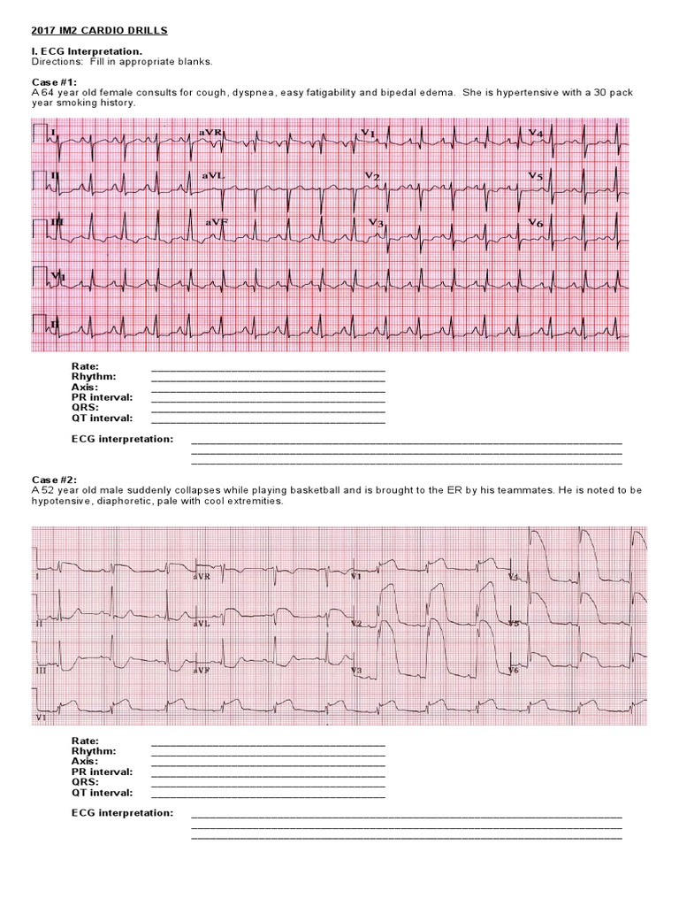 2017 Cardio ECG Drills | PDF | Electrocardiography | Myocardial Infarction