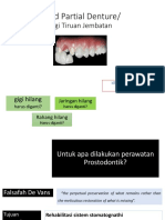 Fixed Partial Denture/: Gigi Tiruan Jembatan