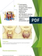 Гипотиреоз презентация