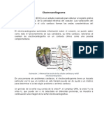 Electrocardiograma