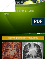 Teknik Pemeriksaan CT Scan Thorax