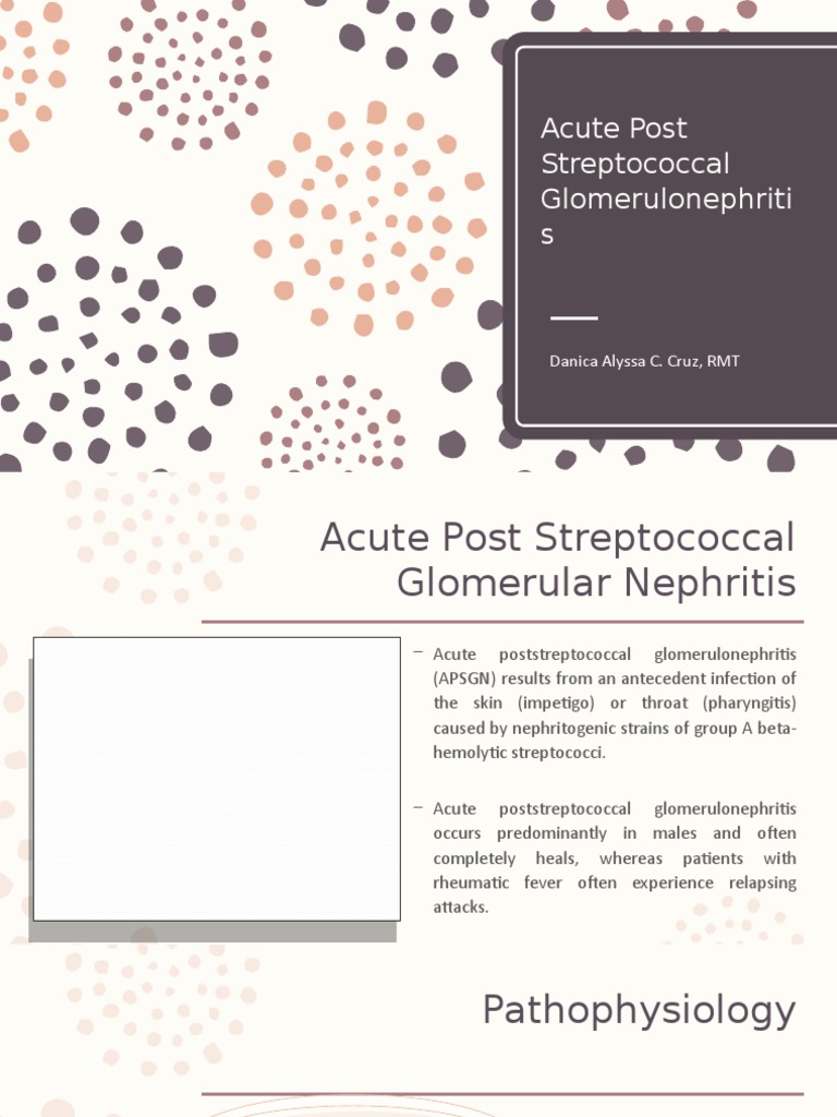 Acute Post Streptococcal Glomerulonephritis PDF Medical Specialties