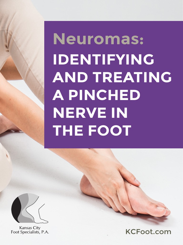 Neuromas Identifying and Treating A Pinched Nerve in The Foot PDF Foot Shoe