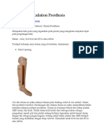 Ankle Disarticulation Prosthesis