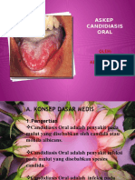 ASKEP candidiasis oral new.pptx