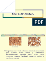 OSTEOPOROZA