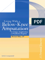 Living With A Below - Knee Amputation - A Unique Insight From A Prosthetist - Amputee - 2005