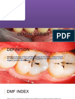 Dental Caries: Siddharth Gautam-76
