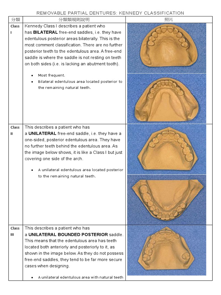 REMOVABLE PARTIAL DENTURE DESIGN PDF visual data 3