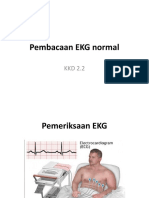 Pembacaan EKG Normal