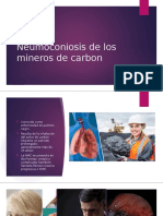 Neumoconiosis de Los Mineros de Carbon