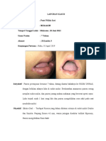 LAPORAN KASUS Angular Cheilitis)