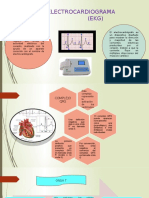 ELECTROCARDIOGRAMA