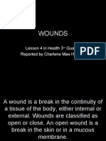 Wounds: Lesson 4 in Health 3 Quarter Reported by Charlene Mae Herrera