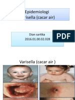 Epidemiologi Cacar Air