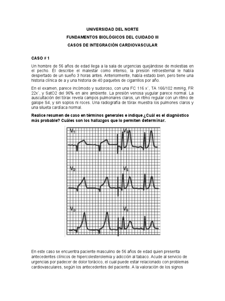 Infarto Agudo: EKG y Diagnóstico Clínico | PDF | Infarto de miocardio ...