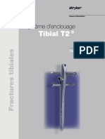 T2 Tibia OpTech_T2-ST-3-FR Rev 1 [60576].pdf