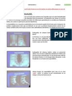 E20. Neuroimagen Columna II