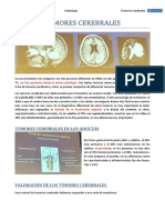 E23 TUMORES CEREBRALES-revisado