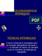 4 - TECNICAS INTRABUCAIS peri (1).pdf