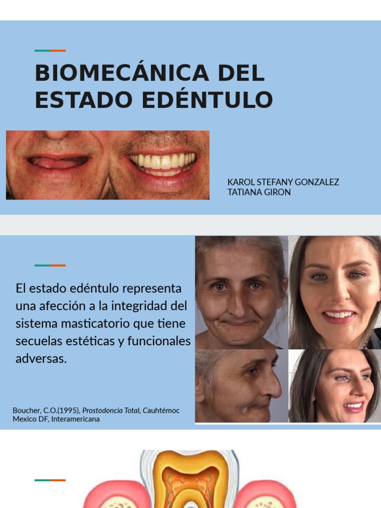 Biomecánica en Pacientes Edéntulos | PDF | Dentadura postiza | Hueso