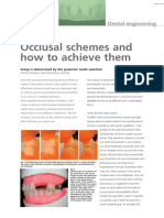 Occlusal Schemes and How To Achieve Them