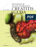 Pancreatitis1 PDF