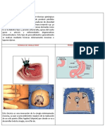 Técnica de Single Port VS Manga Gastrica1