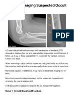 Tips For Managing Suspected Occult Fractures