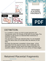 Retained Placental Fragments: By: Celia R. Recel, RN, MAN