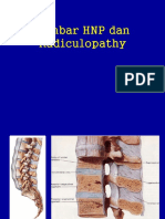 Patologi - HNP D4A