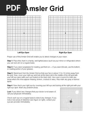 Amsler Grid