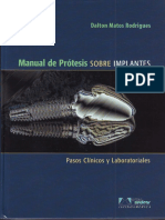 manual de protesis sobre implantes