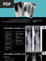 Signo Radiológico Perrito Escoces | PDF | Vértebra | Medicina