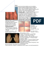 Sclerodermie Sistemică