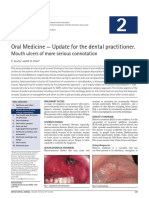 Oral Medicine - Update For The Dental Practitioner.: Mouth Ulcers of More Serious Connotation