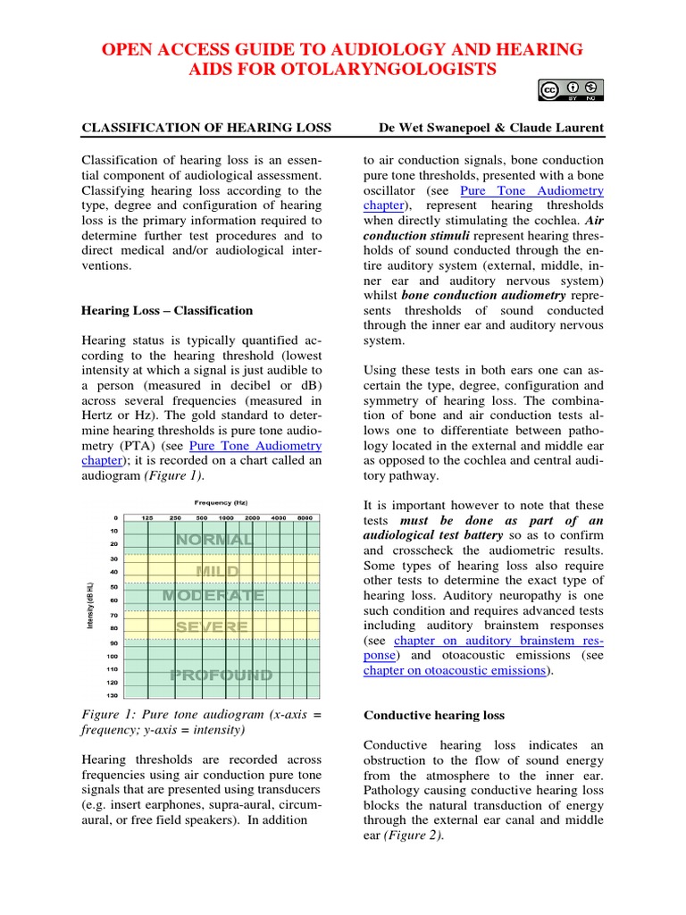 Classification of Hearing Loss | PDF | Hearing | Hearing Loss