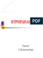 Hypospadias: Presenter: DR Muhammad Saaiq