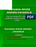 Coroana Mixtă Metalo-Ceramică