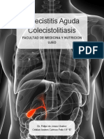 Colecistitis - Colecistolitiasis