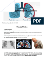 Fibrosis Cuadro Clinico - Odp