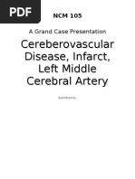 Download CVD by Neil Sabijon SN45821522 doc pdf