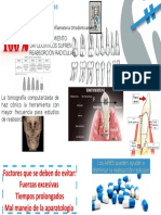 Infografía Efectos perjudiciales de las fuerzas de Ortodoncia