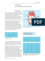 Introducción EKG. ABC of Clinical Electr 2002.