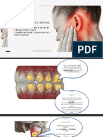 DR Mara Ebook - Você Sabe Qual É o Tipo de Disfunção Temporomandibular Mais Frequente e Que Corresponde A Mais de 80% Dos Casos