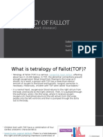 Tetralogy of Fallot: (A Congenital Heart Disease)
