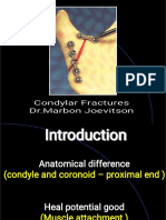 Fracture Condyle PDF